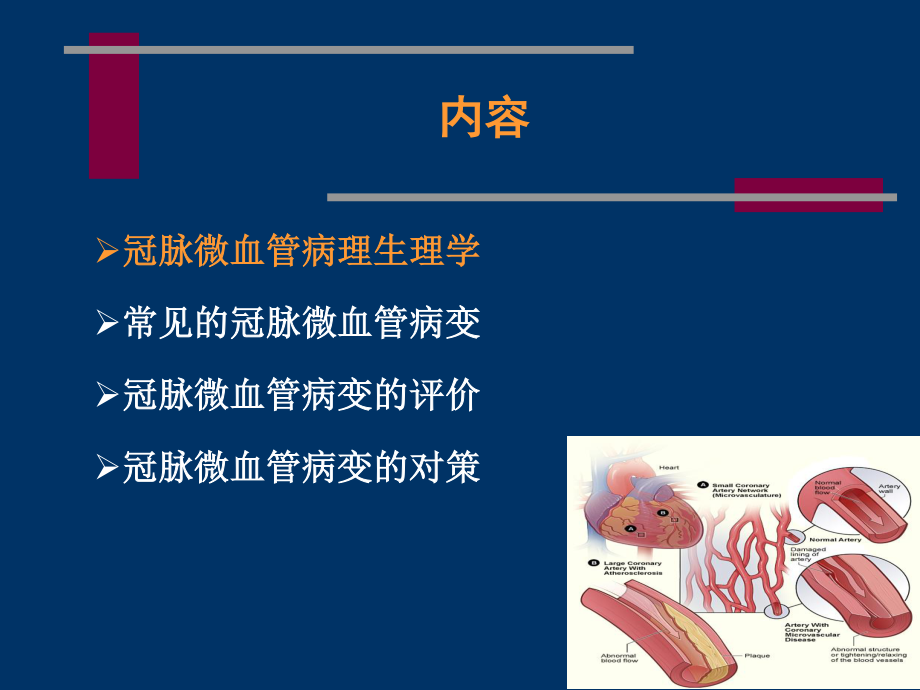 冠状动脉微血管病变及对策.ppt_第2页