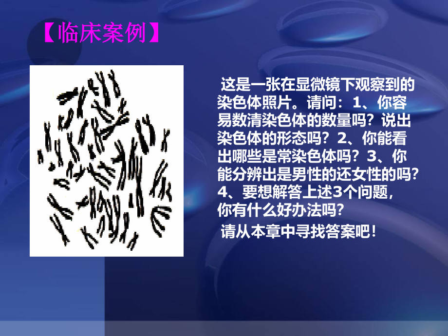 人类染色体与染色体病解读.ppt_第3页