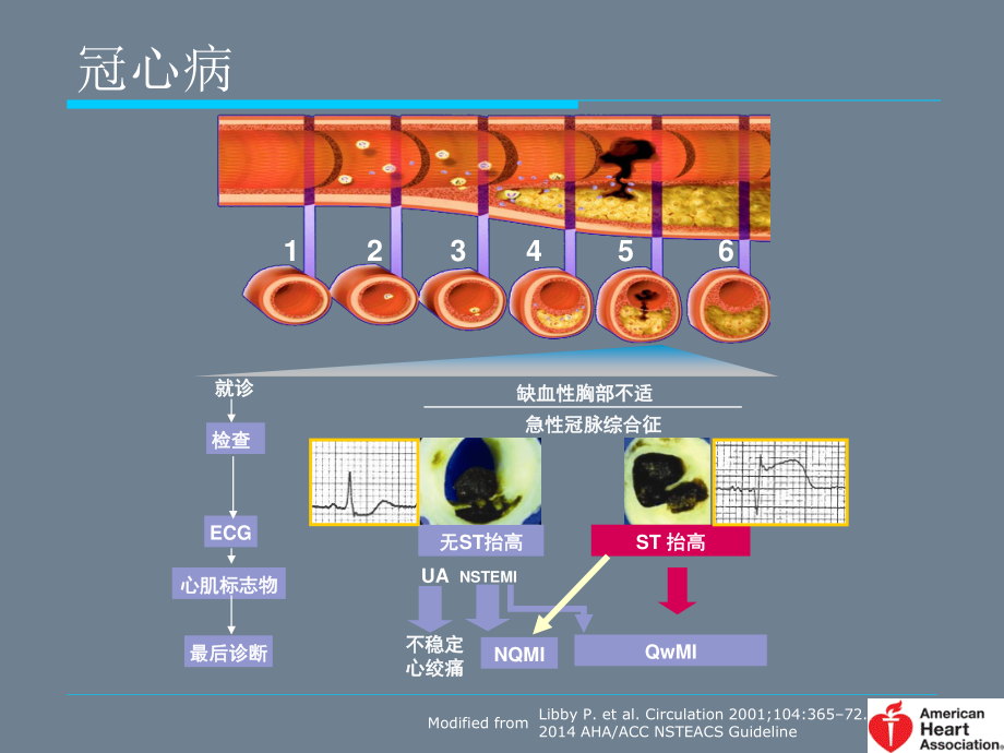 冠心病、房颤危险评分.ppt_第2页