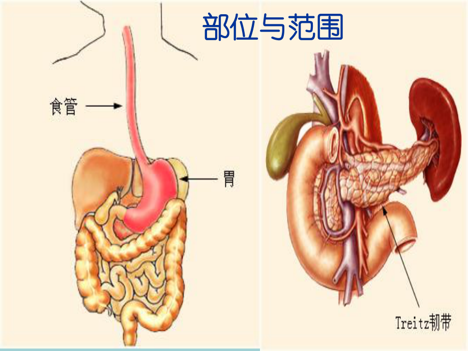 上消化道出血120.ppt_第3页