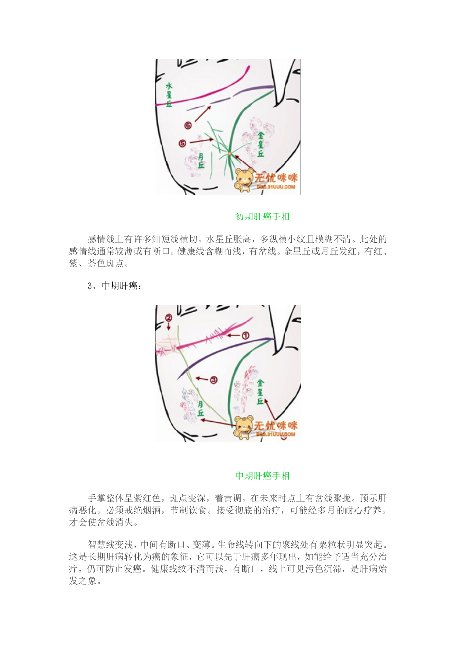 做自己的医生24种手相揭示身心健康问题.doc_第2页