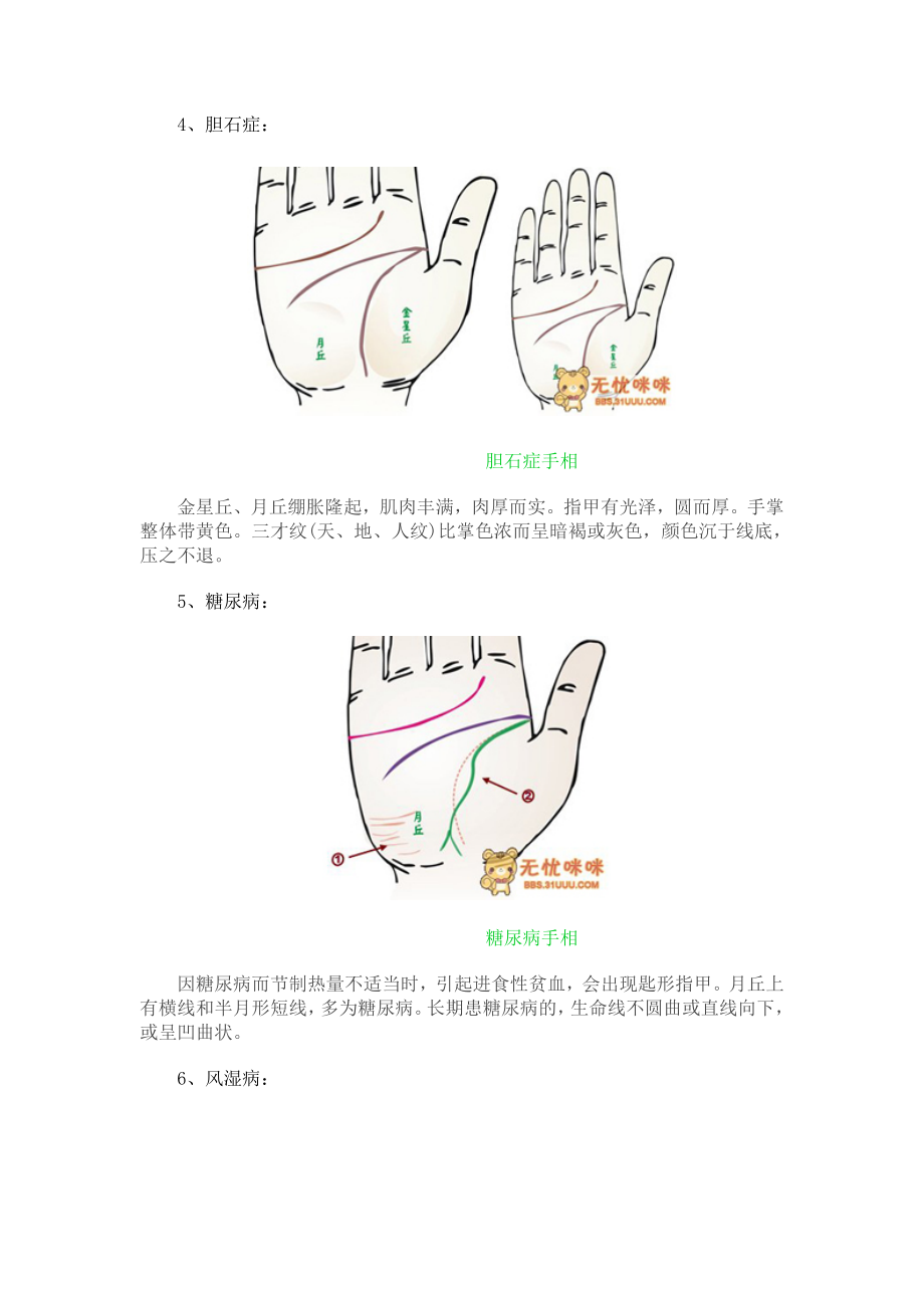 做自己的医生24种手相揭示身心健康问题.doc_第3页