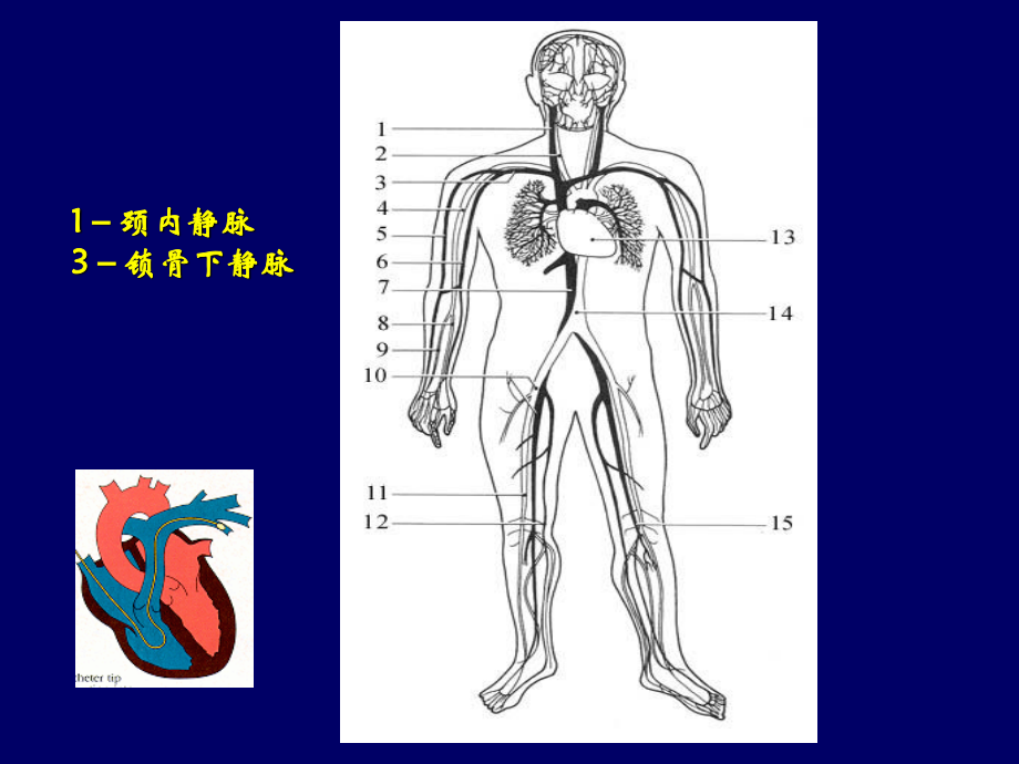 Swan-Ganz导管置入术.ppt_第2页