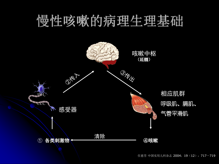 儿童-慢性咳嗽.ppt_第3页