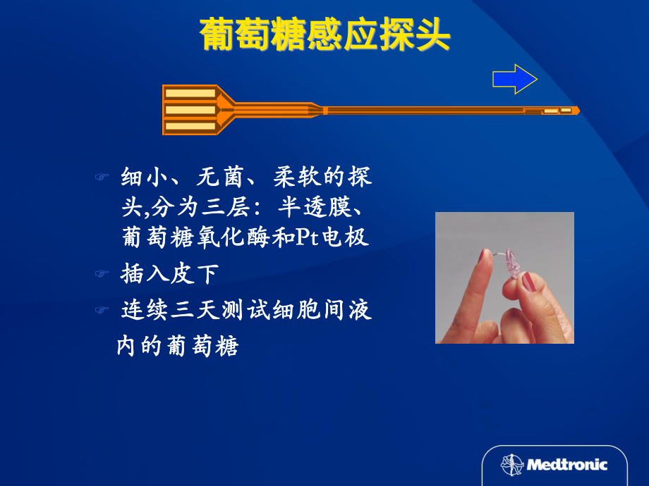 动态血糖仪及未来展望.ppt_第2页