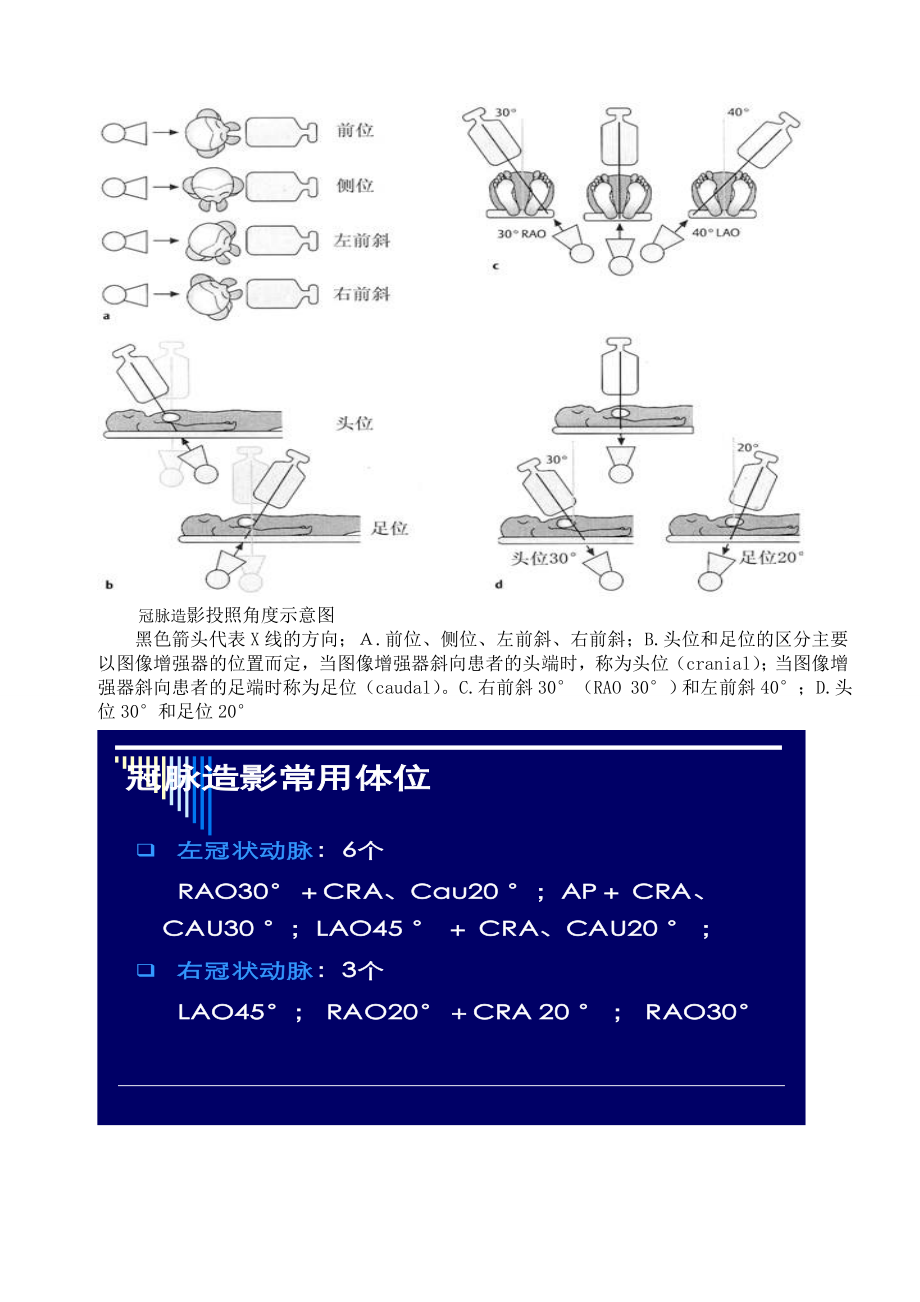 冠状动脉造影体位图片.doc_第2页