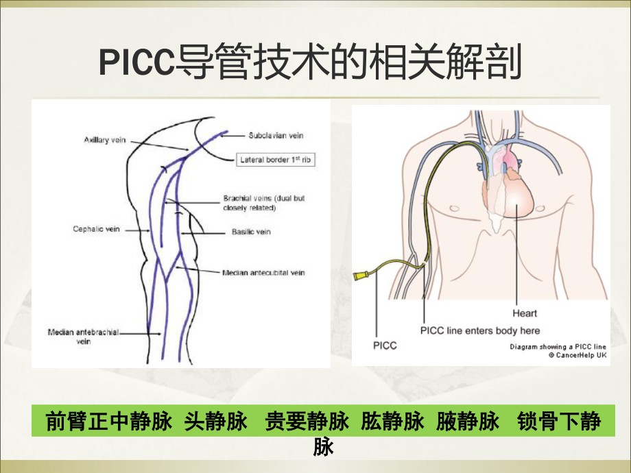 PICC导管头端定位与并发症处理.ppt_第3页