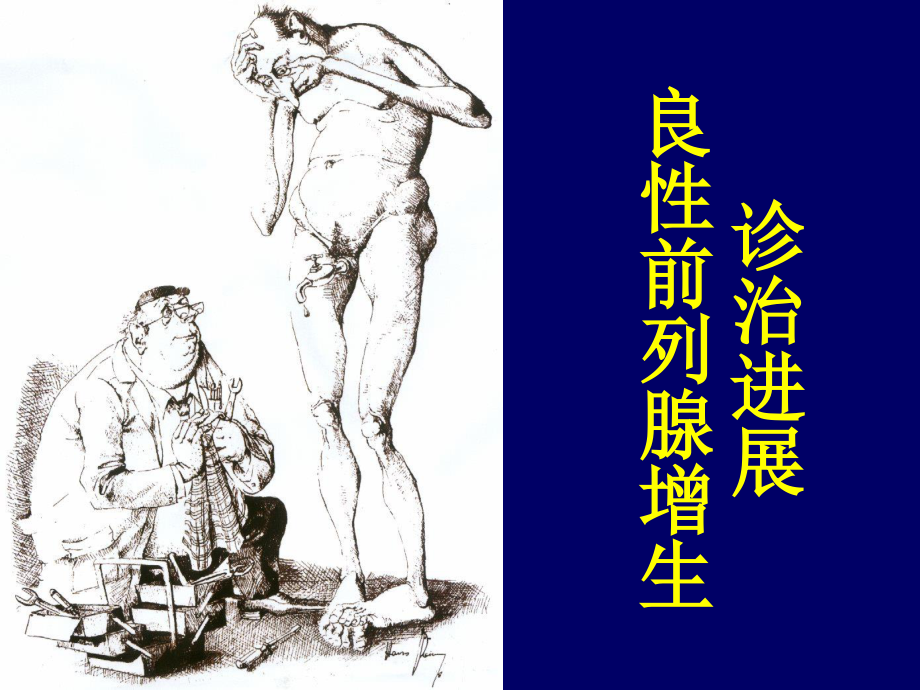 前列腺增生的诊治进展.ppt_第1页