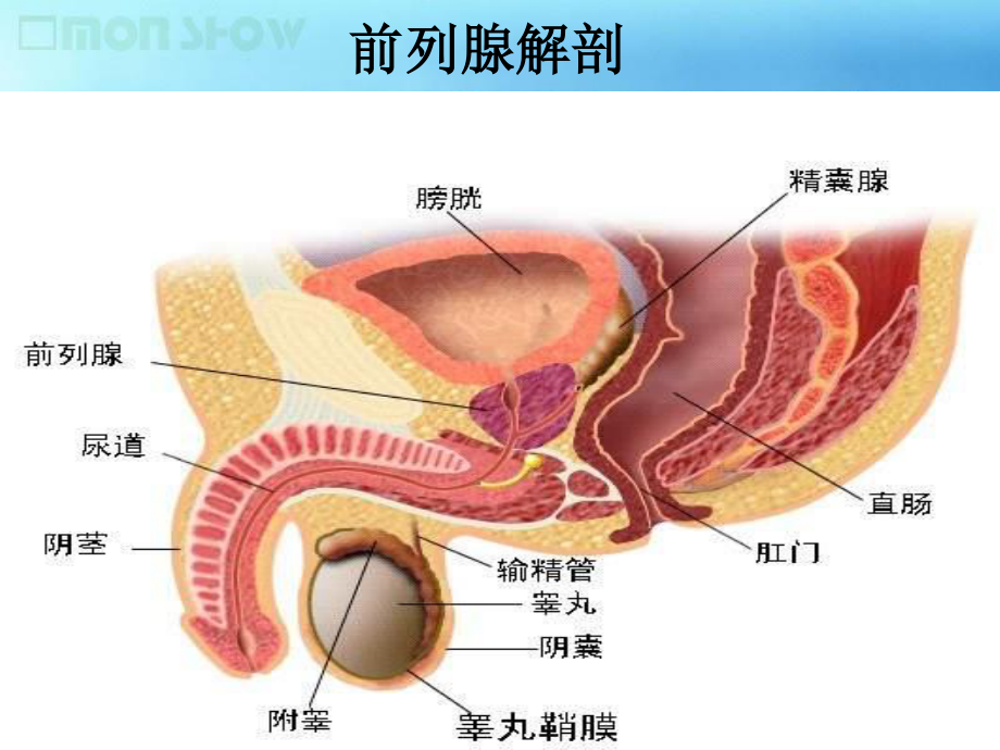 前列腺增生的诊治进展.ppt_第3页