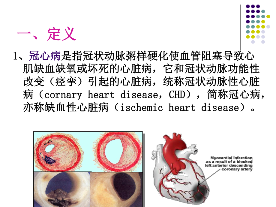 冠状动脉粥样硬化性.ppt_第2页