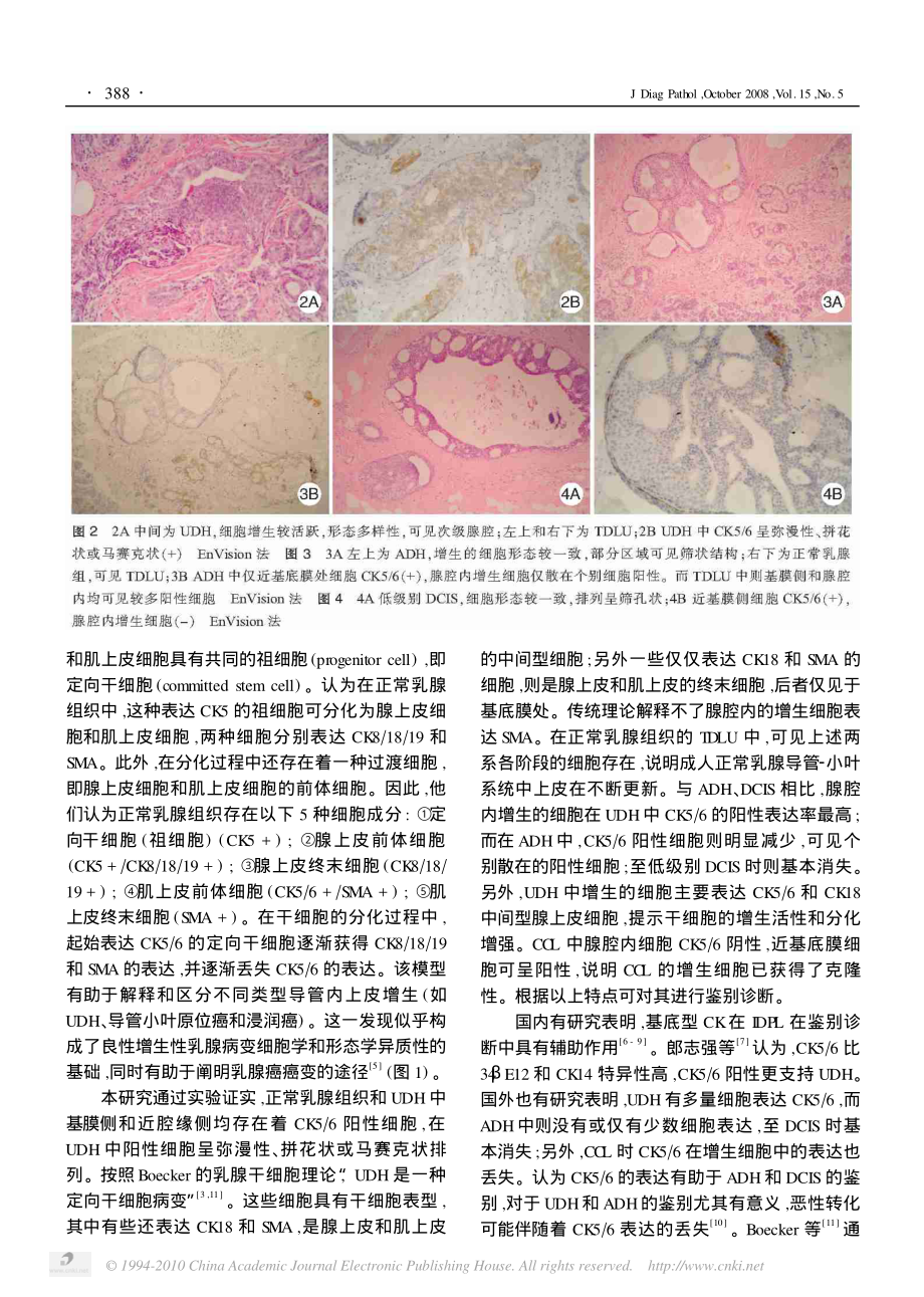 CK5-6在乳腺导管内增生性病变中的表达及意义.pdf_第3页