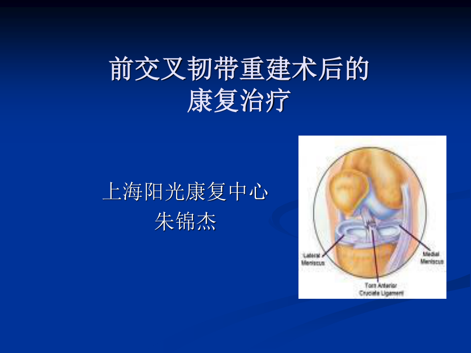 前交叉韧带重建术.ppt_第1页