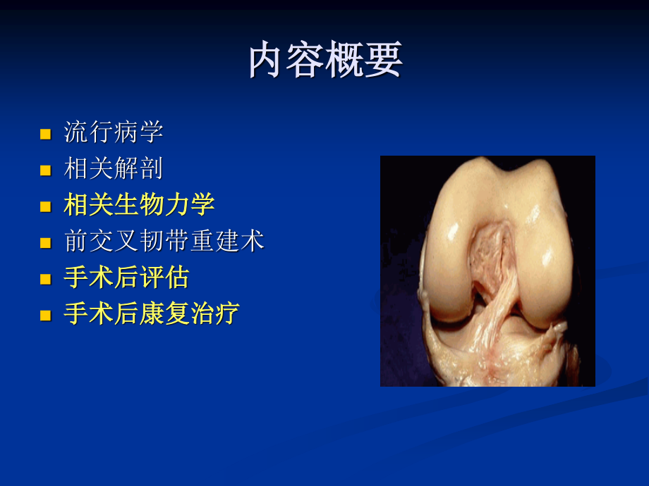 前交叉韧带重建术.ppt_第2页