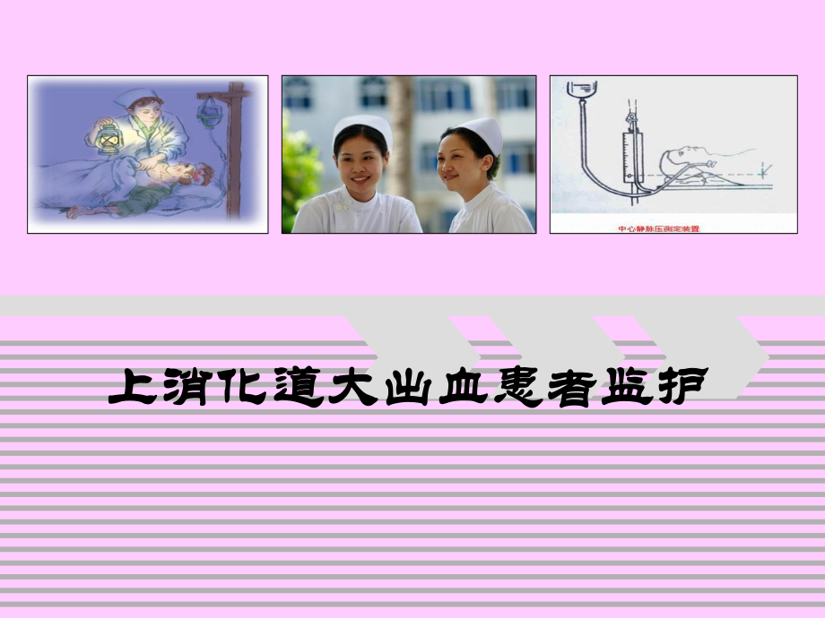 上消化道出血患者监护(2010.11.2).ppt_第1页