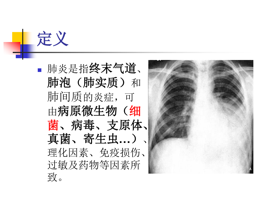 9.肺炎概述.ppt_第3页