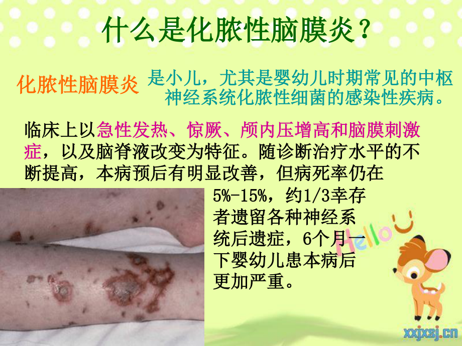 化脓性脑膜炎PPT.ppt_第2页