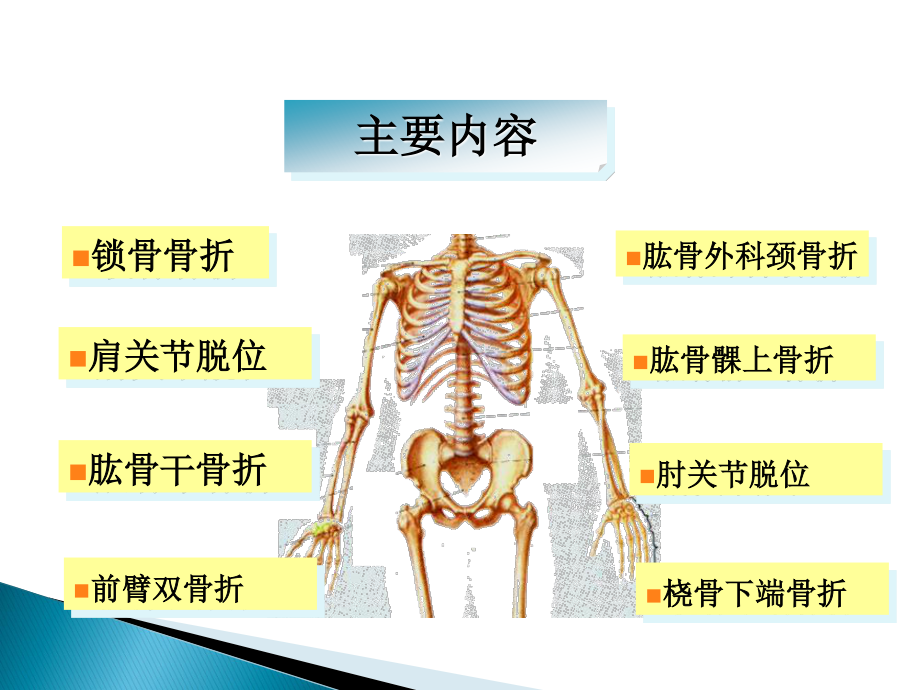 上肢骨折.ppt_第2页