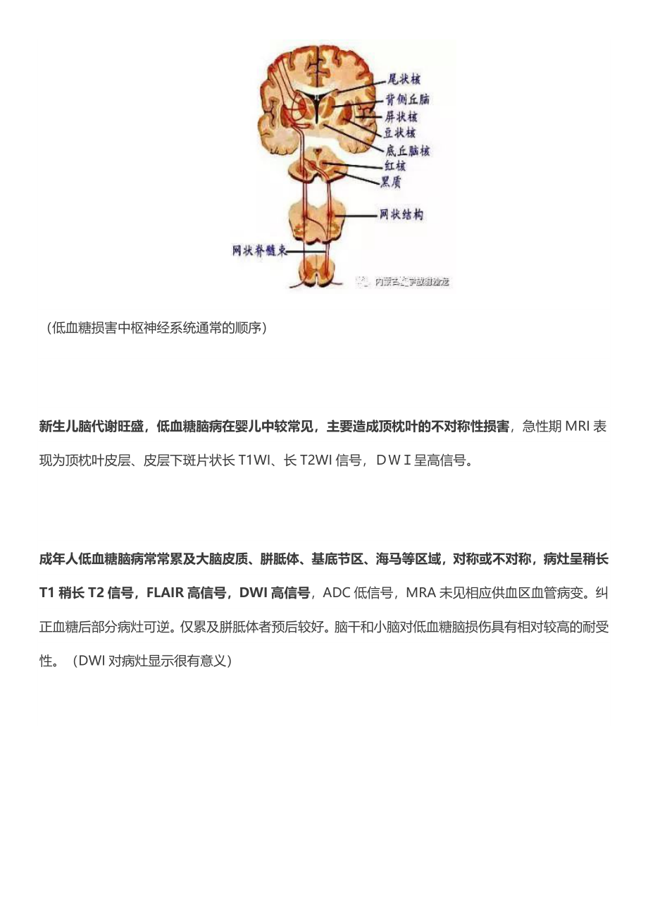 低血糖脑病的MRI表现及鉴别.doc_第2页