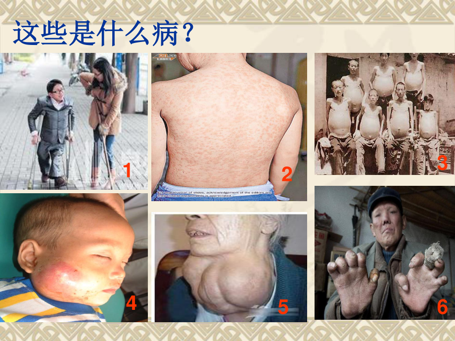 传染病知识简介.ppt_第2页