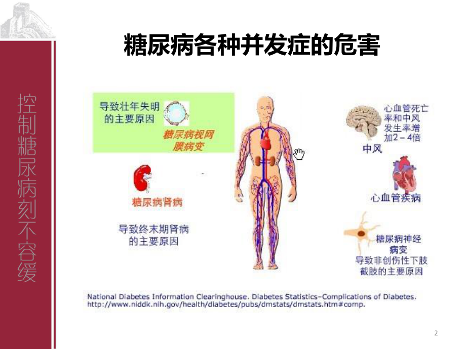 Part7-糖尿病并发症(三).ppt_第2页