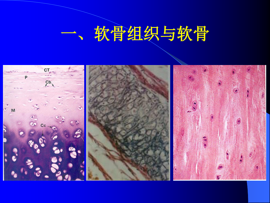 5--软骨组织与骨组织.ppt_第3页