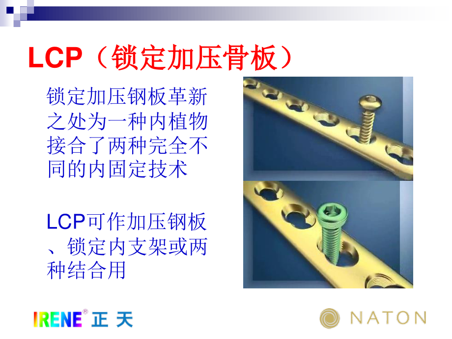 LCP系统接骨板的注意问题及常见问题(免金币).ppt_第2页