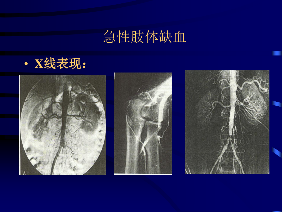 依诺肝素在血管外科的应用.ppt_第3页