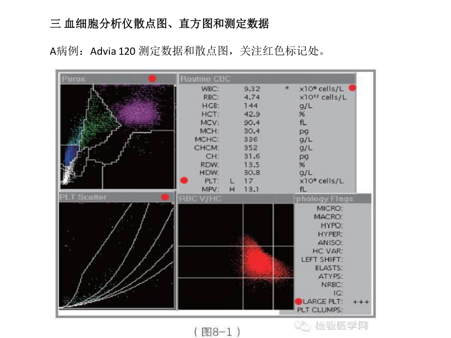 EDTA依赖性假性血小板减少.pptx_第3页