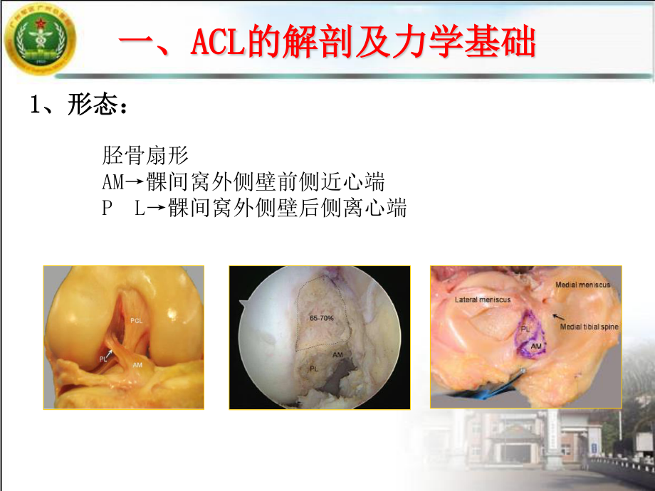 单隧道双束前交叉韧带重建的中期疗效观察.ppt_第3页