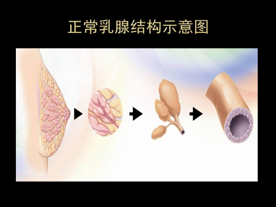 乳腺增生.ppt_第3页