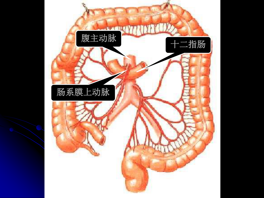 十二指肠淤积症.ppt_第3页