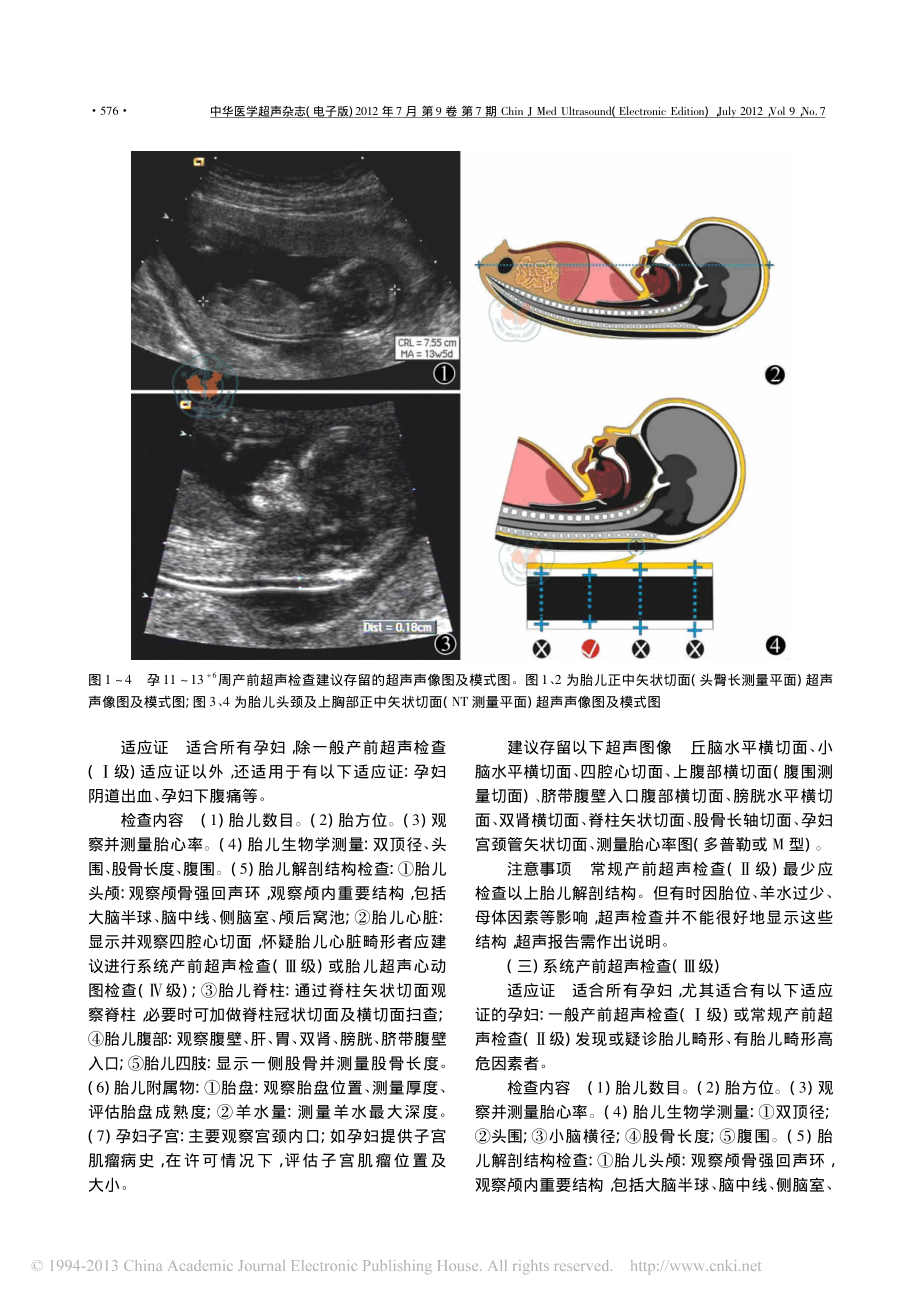 产前超声检查指南(2012).pdf_第3页