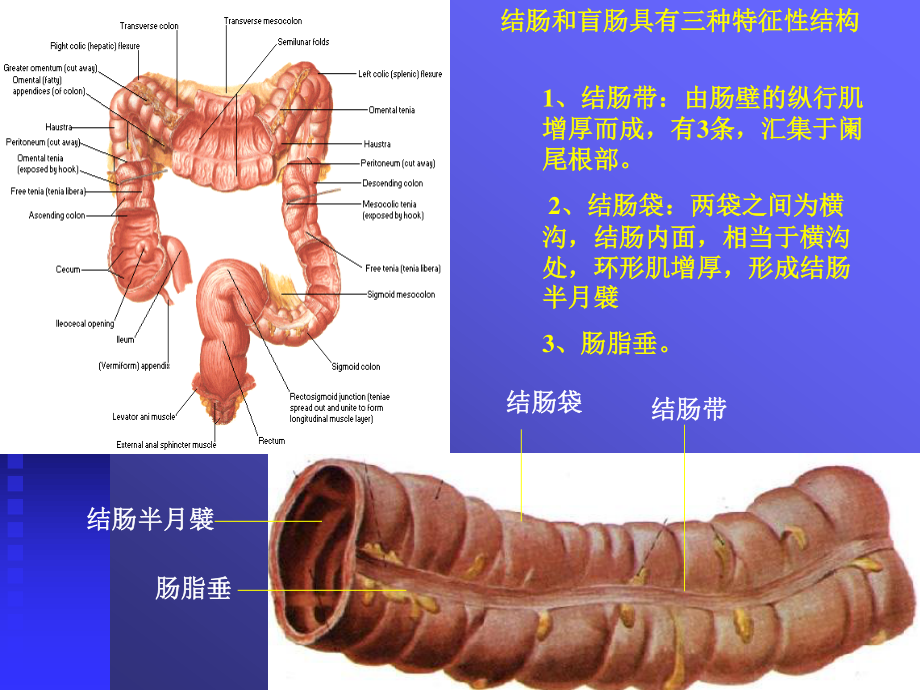 上消化道出血03本科.ppt_第3页