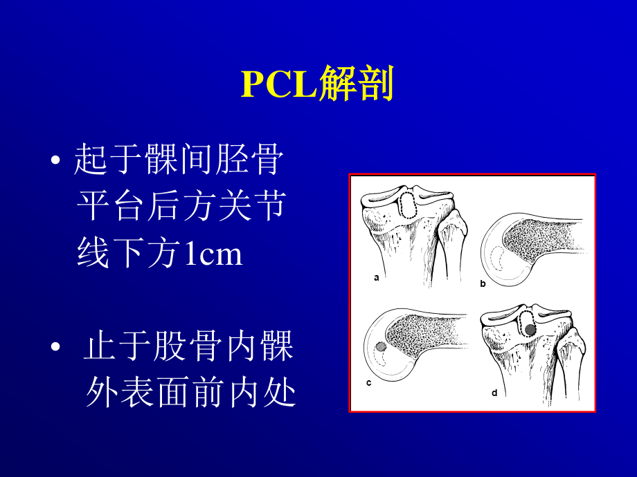 关节镜下的后交叉韧带重建术.ppt_第2页