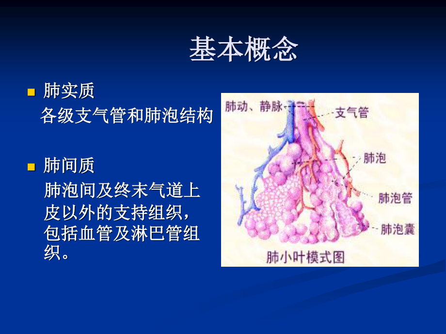 4-特发性肺纤维化.ppt_第2页