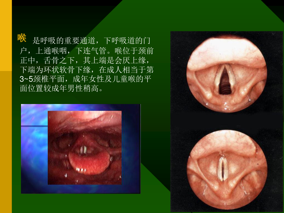 喉阻塞与气管切开相关知识.ppt_第3页