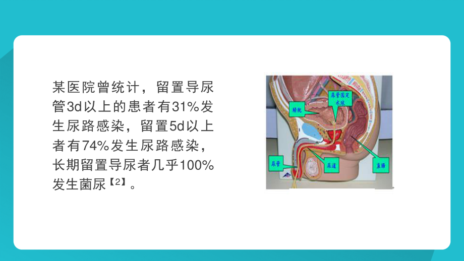 如何减少留置导尿引发的感染.pptx_第3页