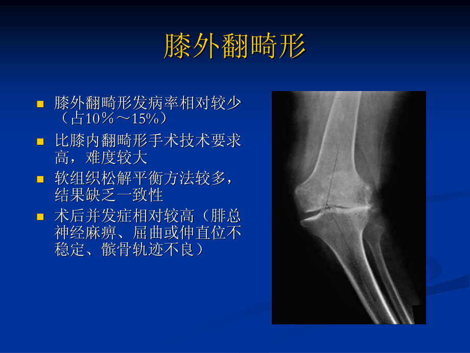 膝外翻畸形全膝关节置换剖析.pdf_第2页