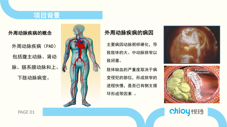 血管工作站-糖尿病.pptx_第3页