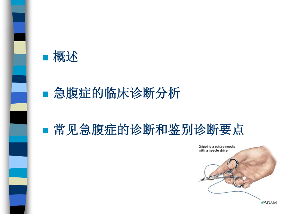 急腹症4-23.ppt_第2页