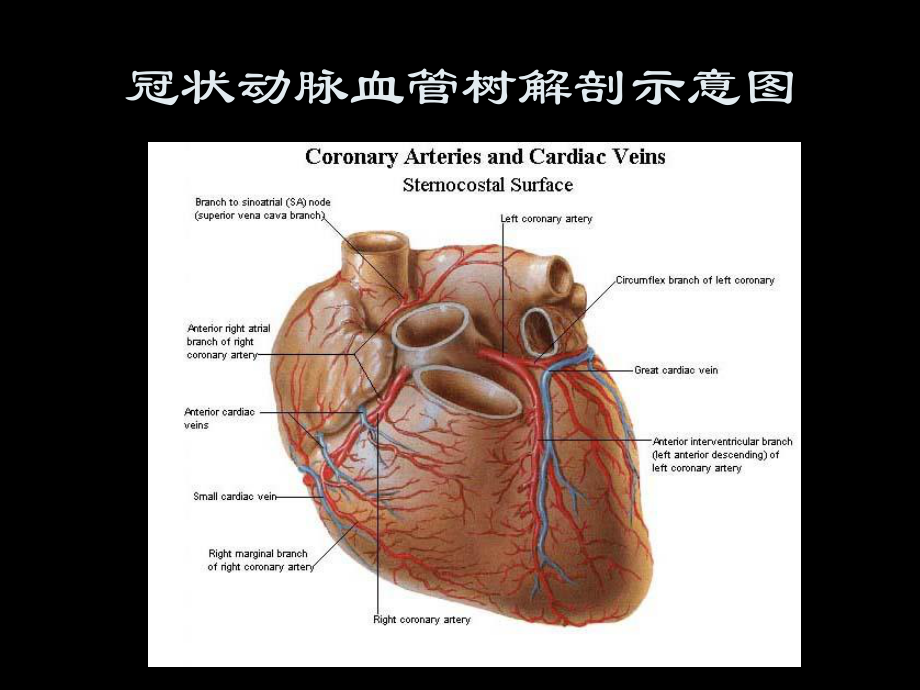 急性心肌梗死的危险.ppt_第3页