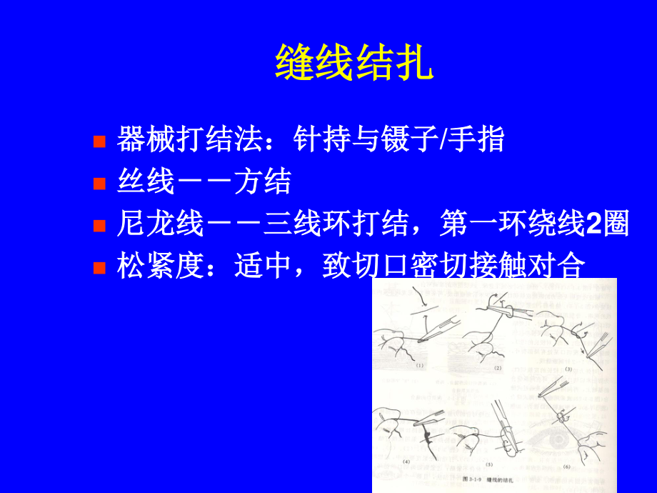 眼科显微手术器械及基本技能.ppt_第3页