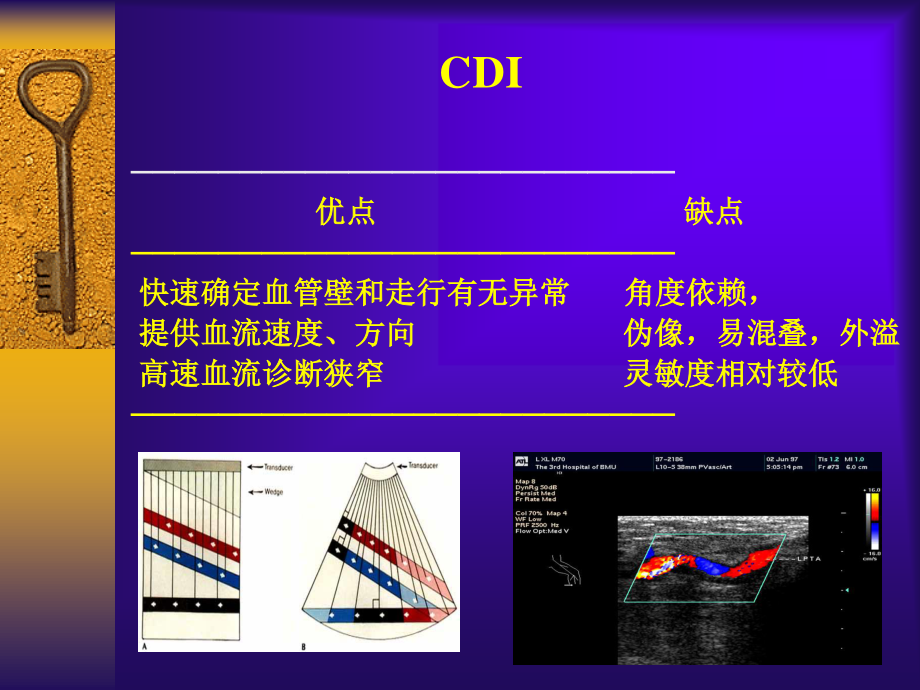 彩色多普勒超声在颈部血管的应用勇强.ppt_第2页