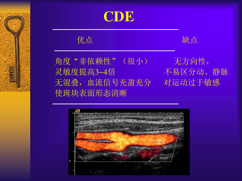 彩色多普勒超声在颈部血管的应用勇强.ppt_第3页