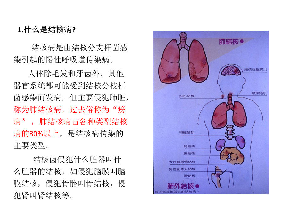 学校结核病防治知识.pptx_第2页