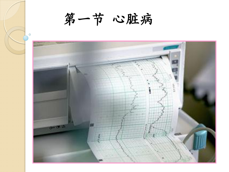 妊娠期合并症(精).ppt_第2页