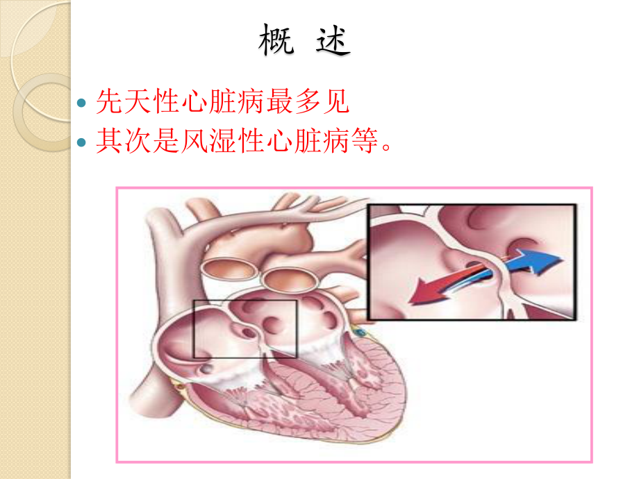 妊娠期合并症(精).ppt_第3页