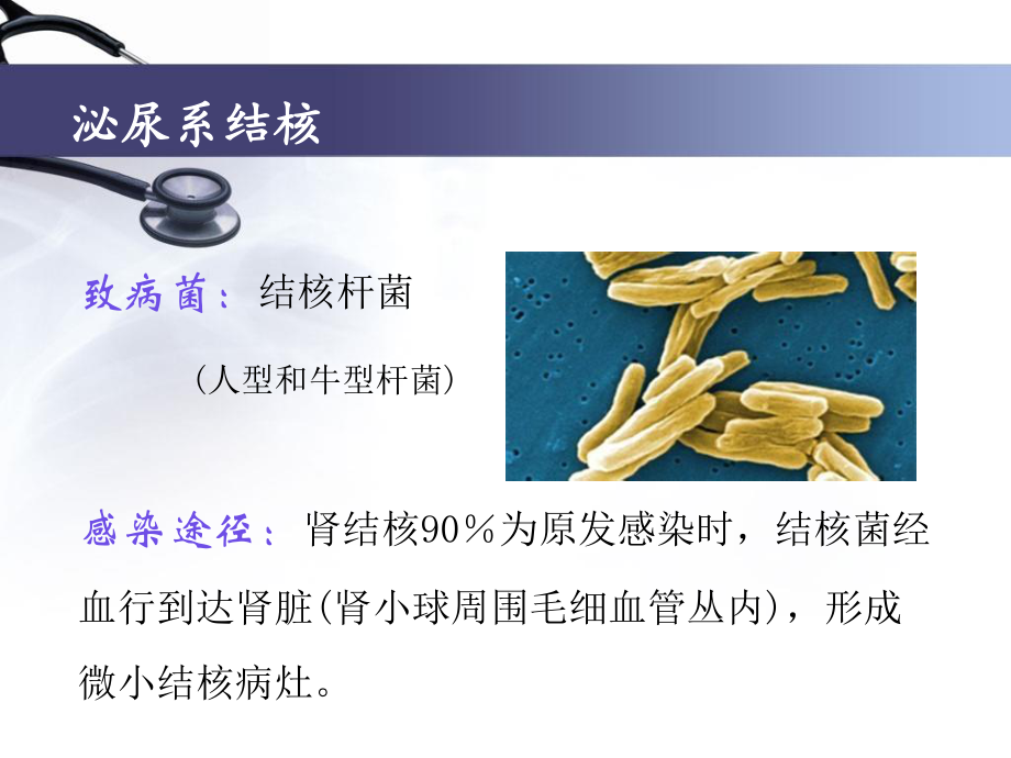 泌尿、男生殖系统结核.ppt_第2页