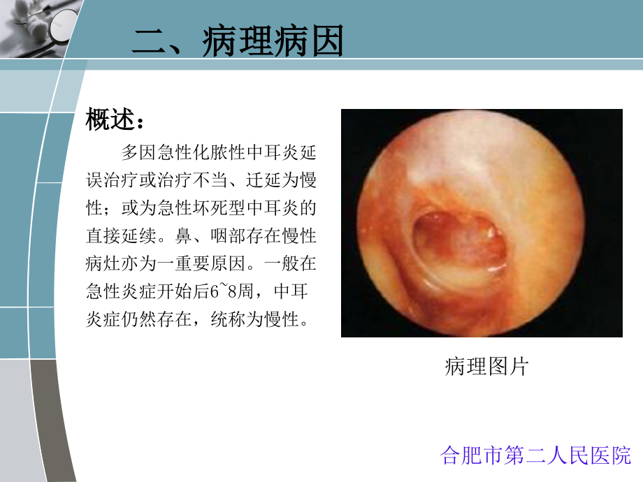 慢性化脓性中耳炎qq系列.ppt_第3页