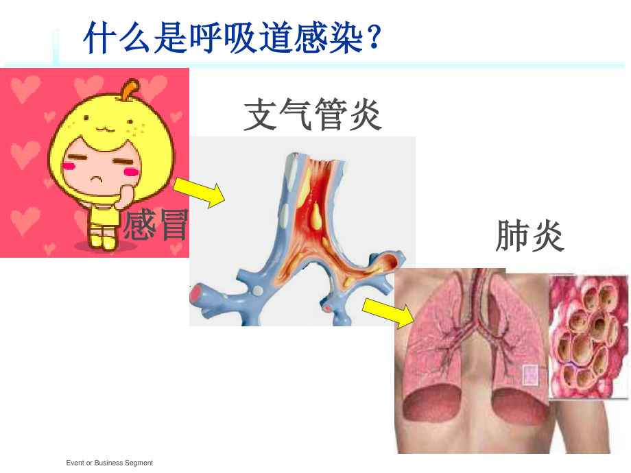 呼吸道感染的防治.ppt_第2页